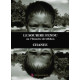 Le sourire fendu ou l'histoire de Gibbon
