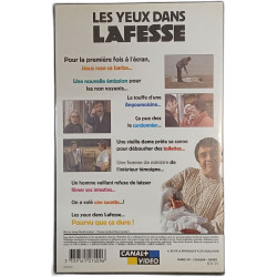 Les yeux dans Lafesse