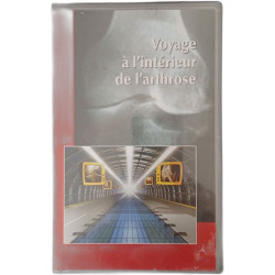 Voyage à l'intérieur de l'arthrose