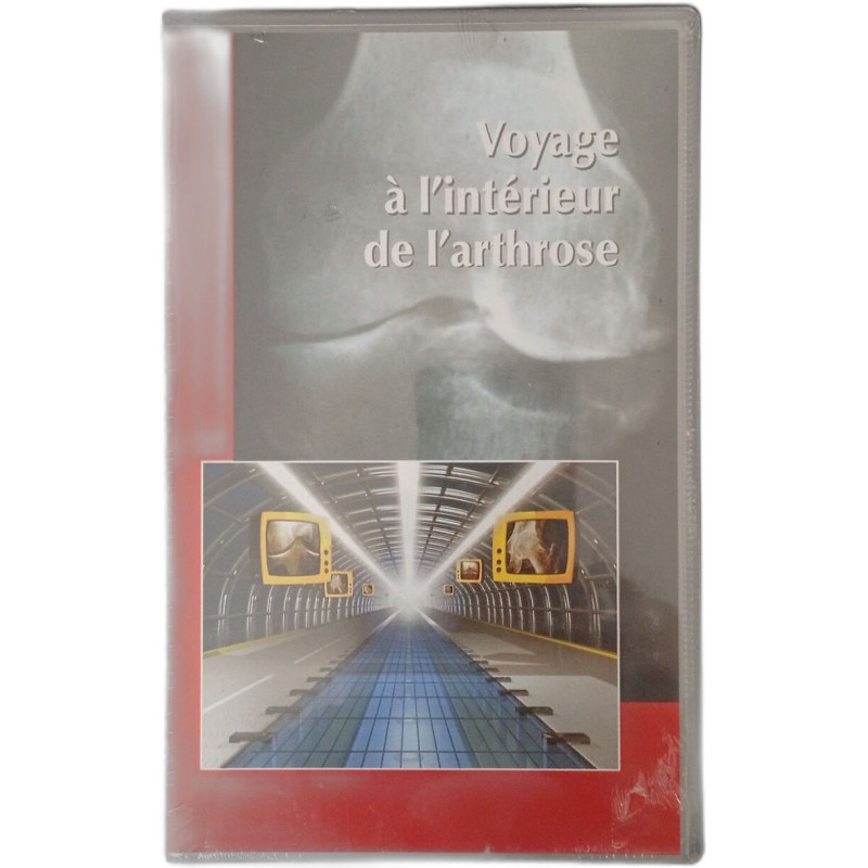 Voyage à l'intérieur de l'arthrose
