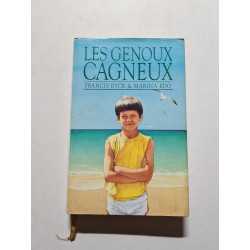 Les genoux cagneux