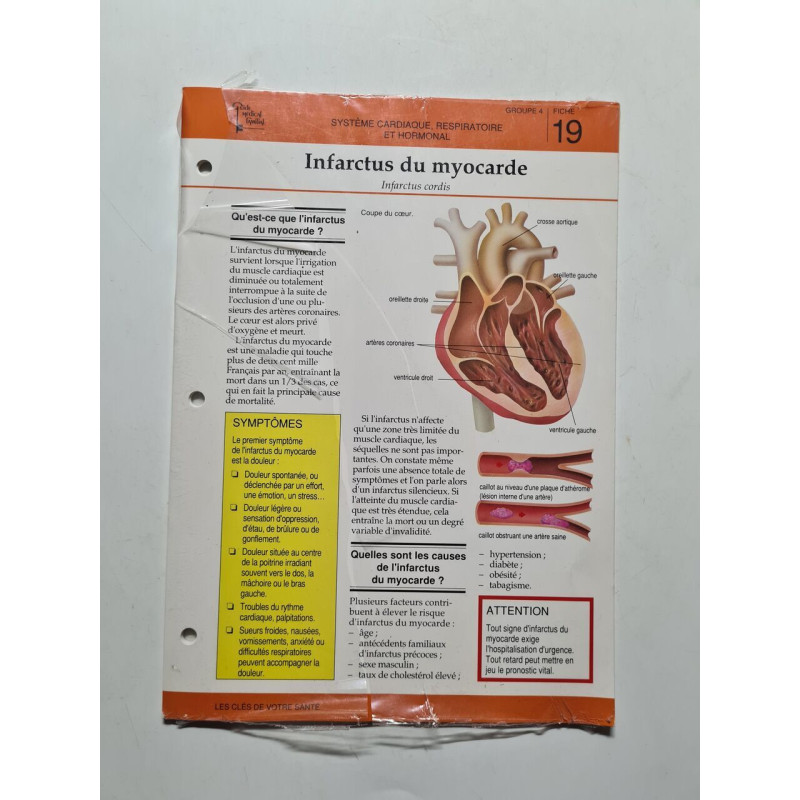 Infarctus du myocarde 19