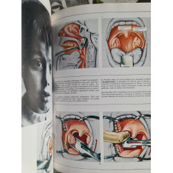 Les maladies infantiles