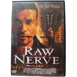 Raw Nerve