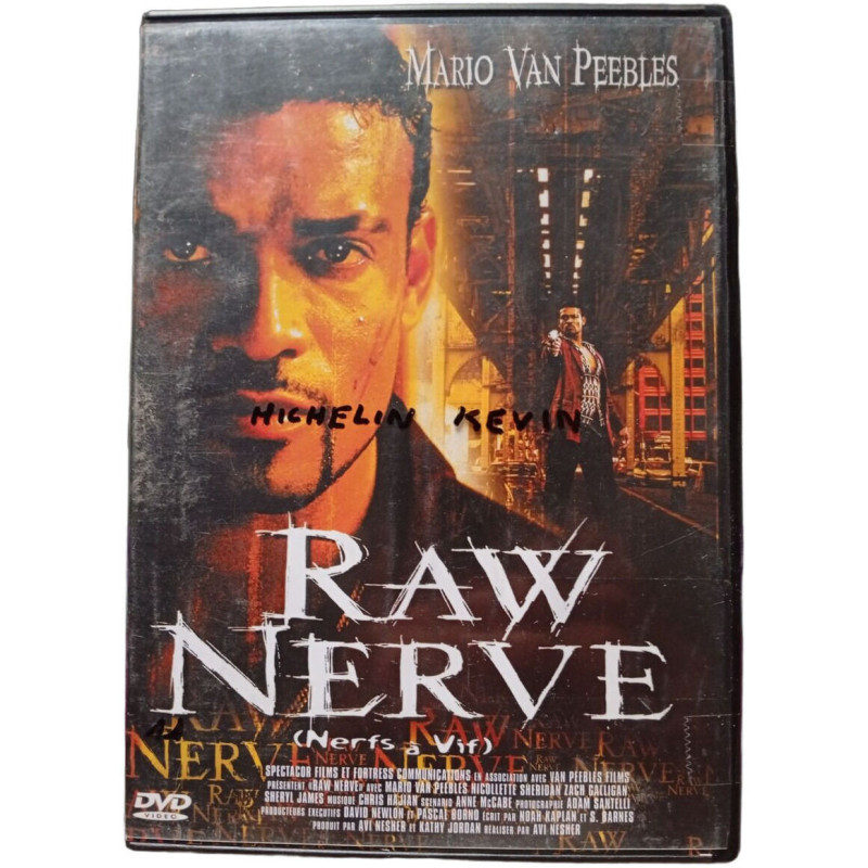 Raw Nerve