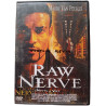 Raw Nerve